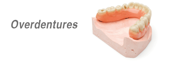 Sobre dentaduras